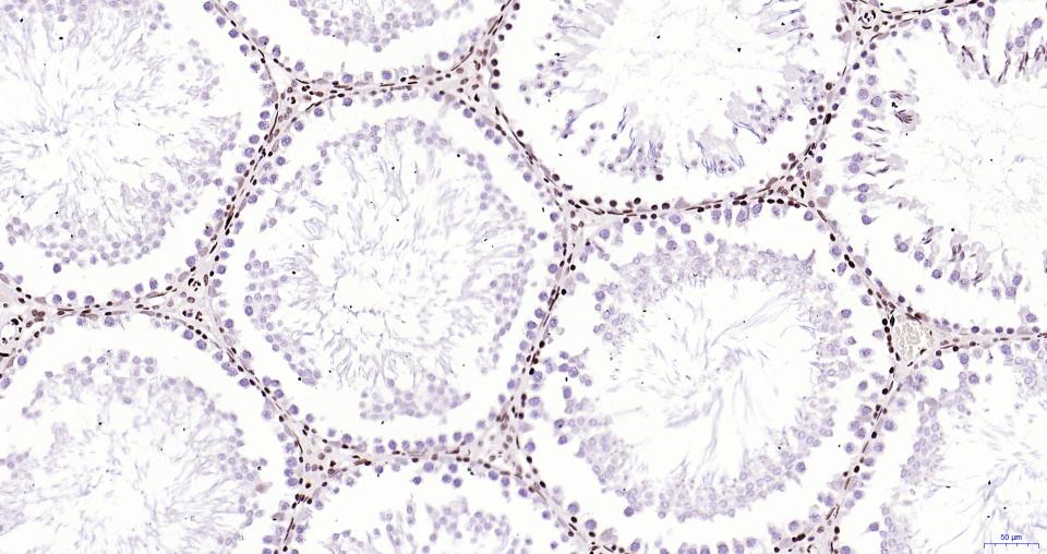 乙酰化组蛋白H3.1(Lys28)重组兔单抗