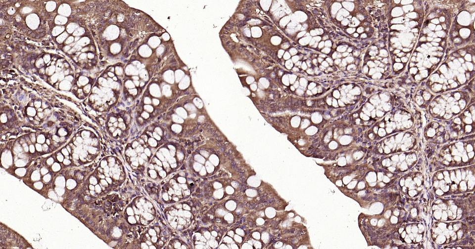 泛素蛋白（K63-linkage）重组兔单抗