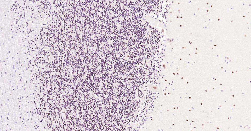 磷酸化CREB-1重组兔单抗