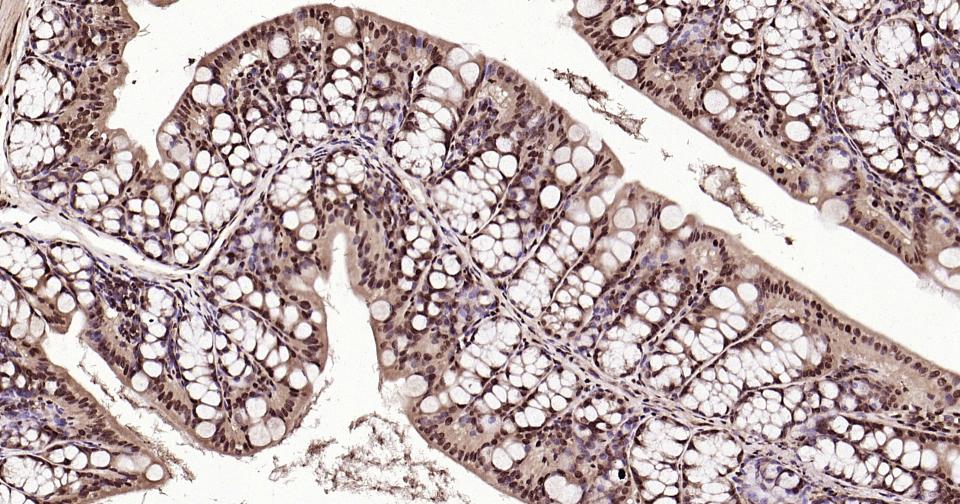 泛素蛋白（K27-linkage specific）重组兔单抗