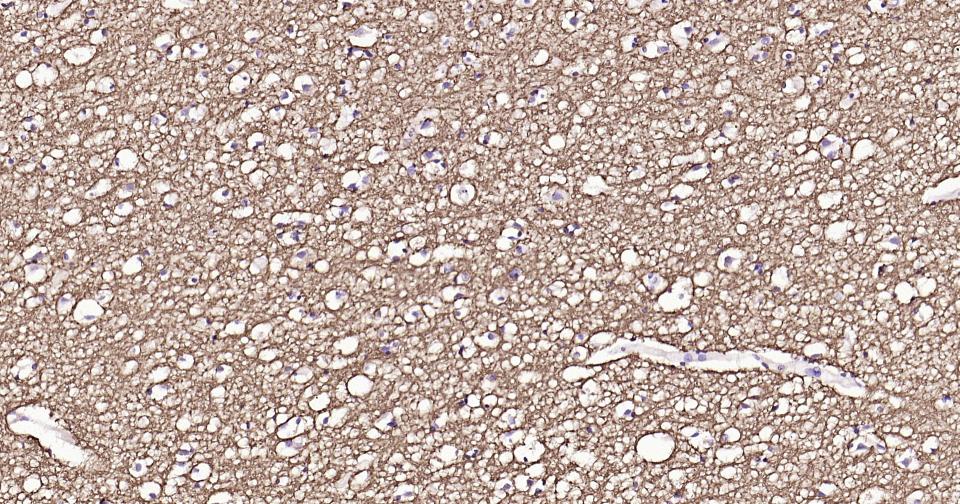 髓鞘碱性蛋白/磷脂碱性蛋白重组兔单抗