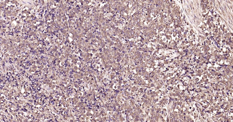 泛素蛋白（K63-linkage）重组兔单抗