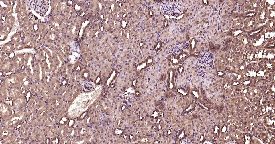 泛素蛋白（K63-linkage）重组兔单抗