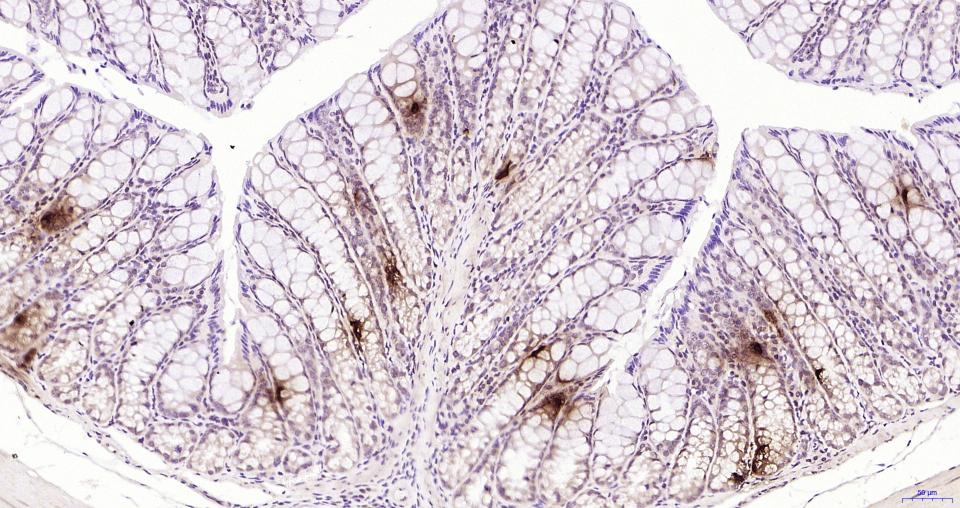 胰高血糖素重组兔单抗
