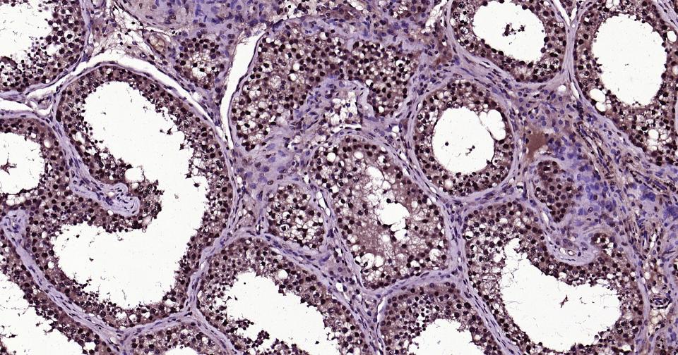 泛素蛋白（K27-linkage specific）重组兔单抗