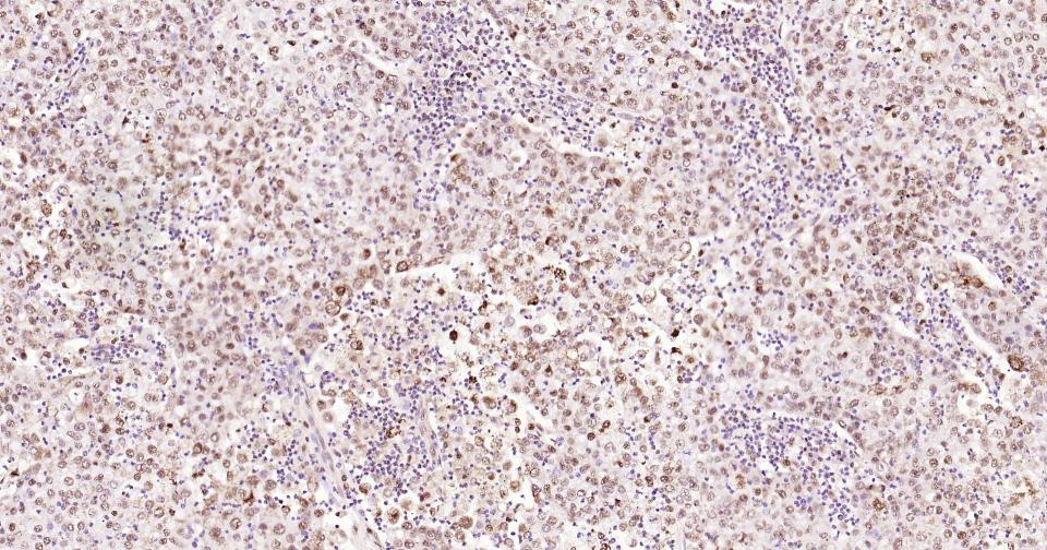 磷酸化CREB-1重组兔单抗