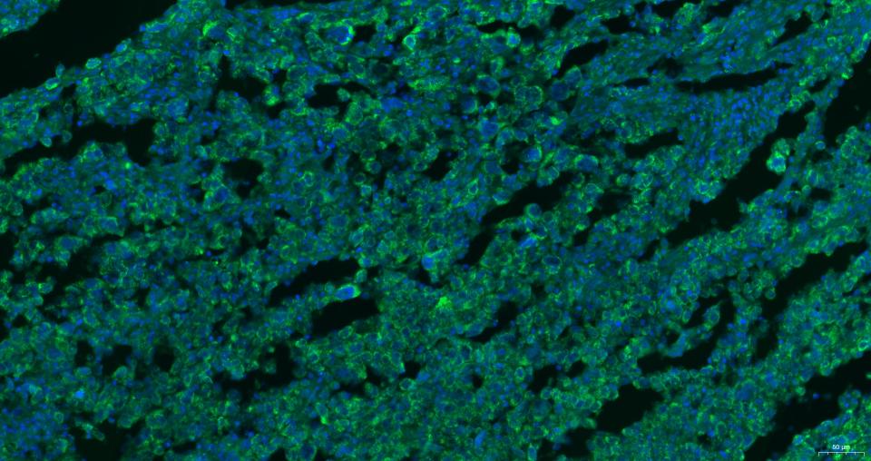细胞表面趋化因子受体4抗体-bs-1011R