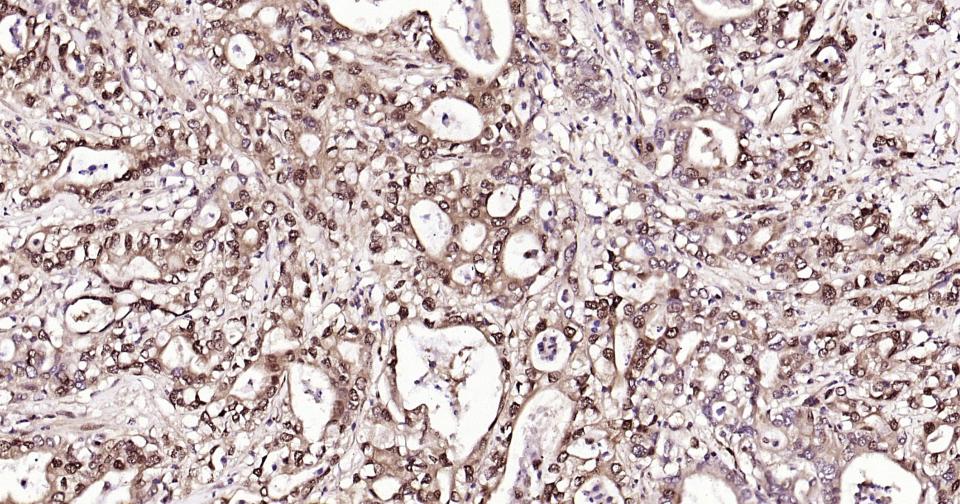 泛素蛋白(K48-linkage)重组兔单抗