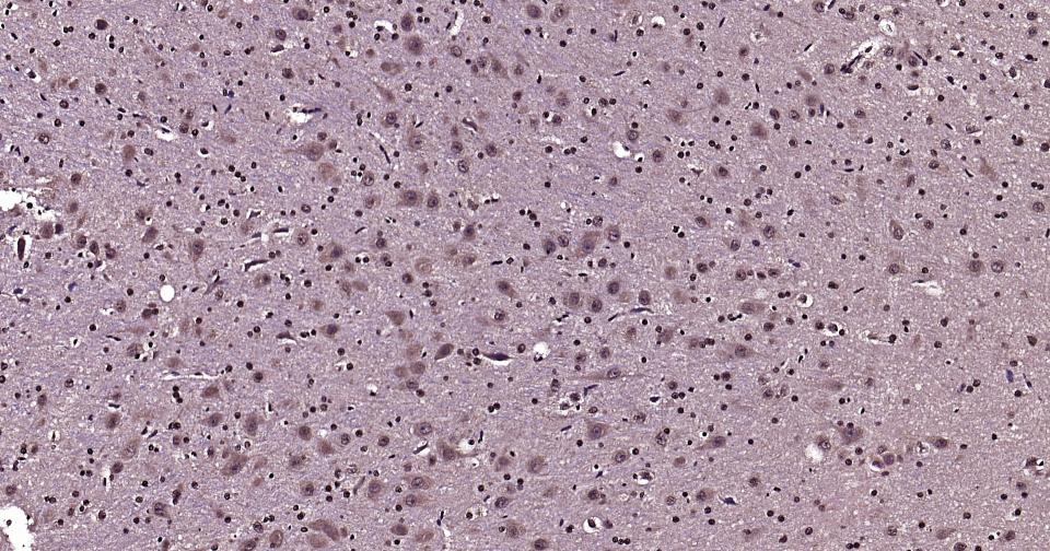 泛素蛋白（K27-linkage specific）重组兔单抗