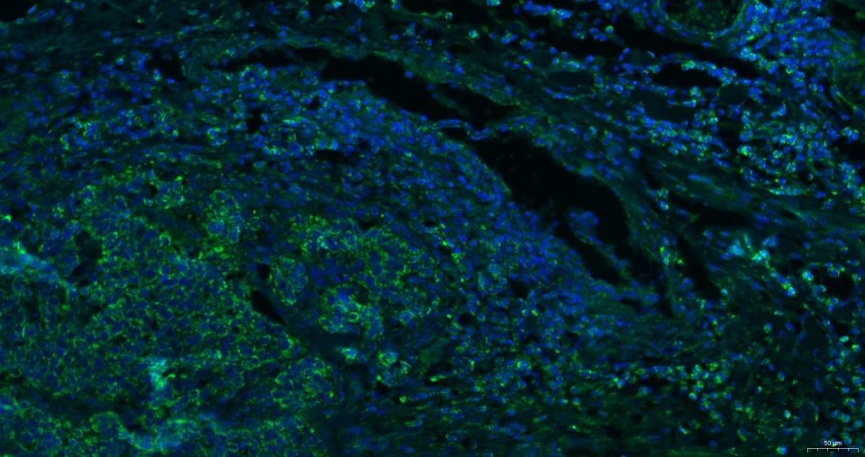细胞表面趋化因子受体4抗体-bs-1011R