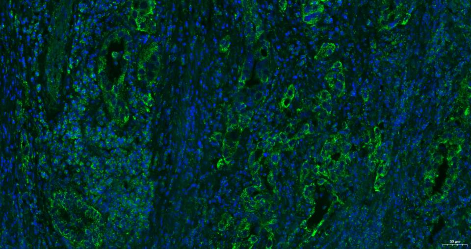 细胞表面趋化因子受体4抗体-bs-20317R