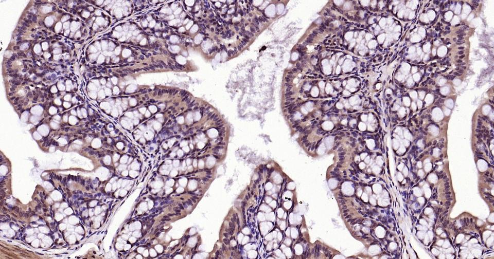 泛素蛋白(K48-linkage)重组兔单抗