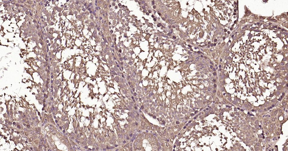 泛素蛋白（K63-linkage）重组兔单抗