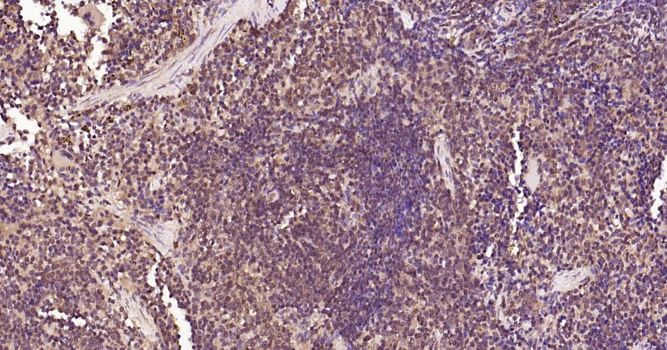 泛素蛋白(K48-linkage)重组兔单抗