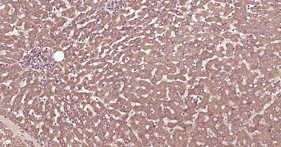 泛素蛋白（K27-linkage specific）重组兔单抗