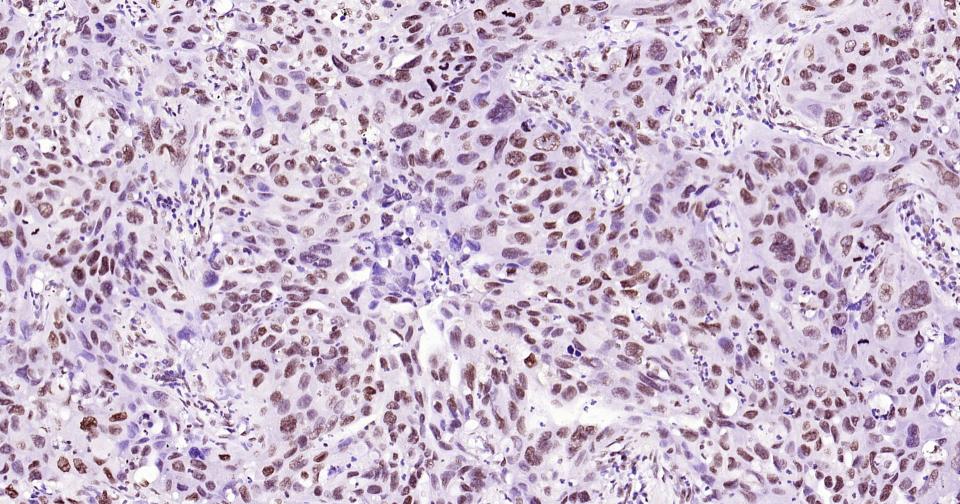 组蛋白H3(核内参)单克隆抗体-bsm-33042M