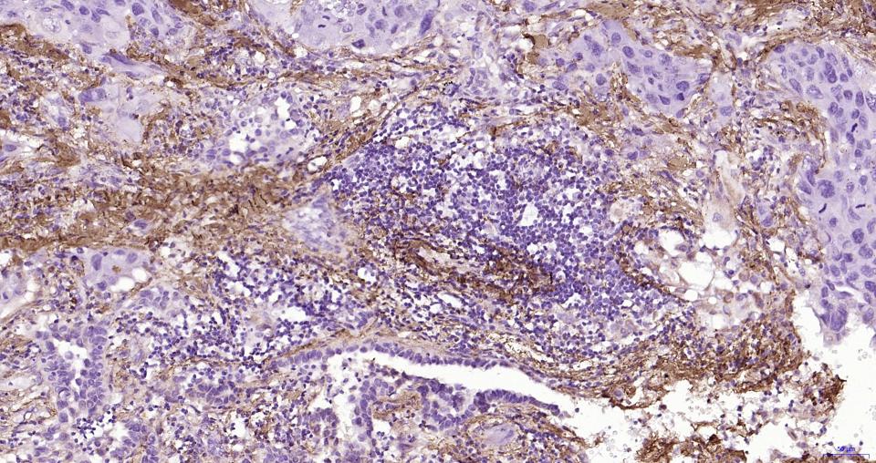 纤维连接蛋白重组兔单抗