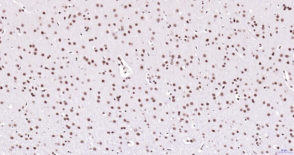 乙酰化组蛋白H3.1(Lys28)重组兔单抗