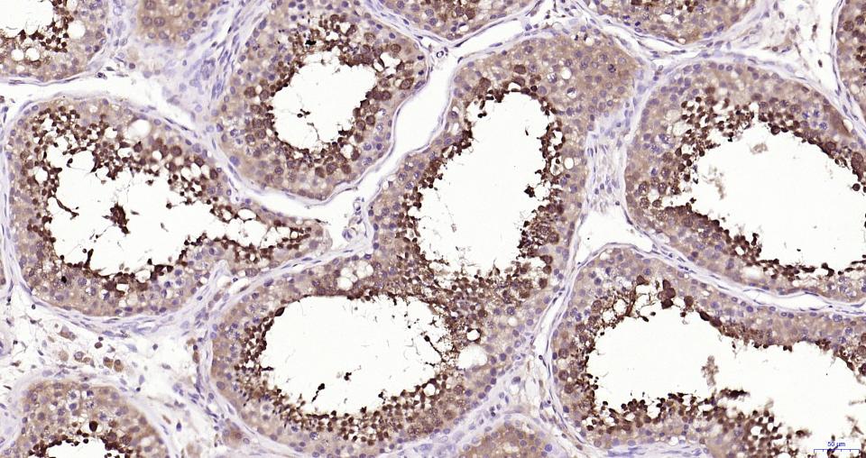 谷胱甘肽过氧化酶4重组兔单抗