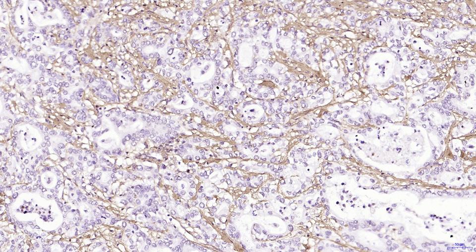 纤维连接蛋白重组兔单抗