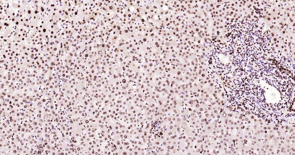 组蛋白H3(核内参)单克隆抗体-bsm-33042M