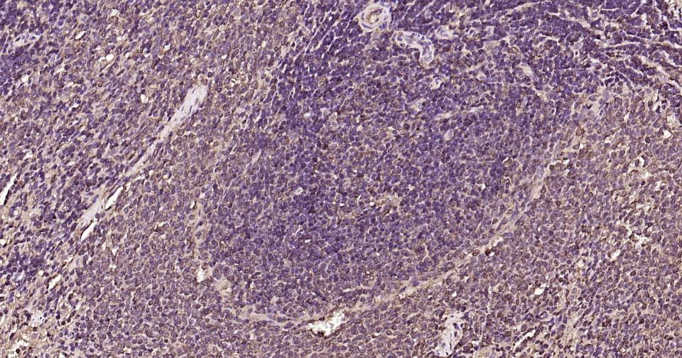 泛素蛋白重组兔单抗