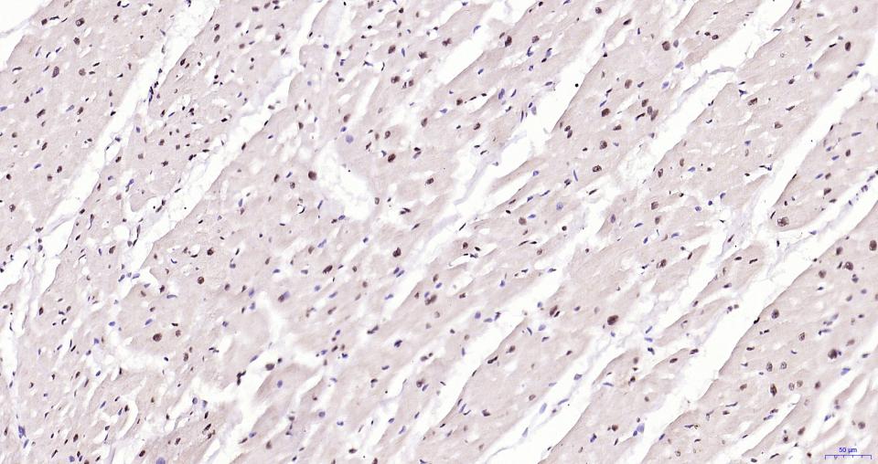 乙酰化组蛋白H3.1(Lys28)重组兔单抗