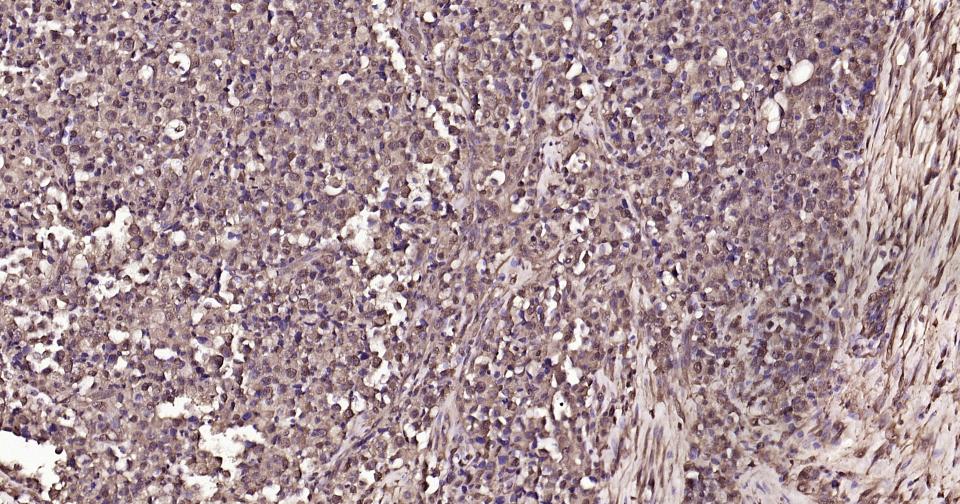 泛素蛋白重组兔单抗