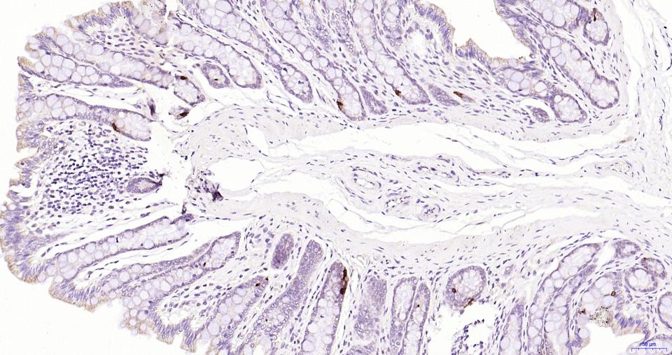 胰高血糖素重组兔单抗