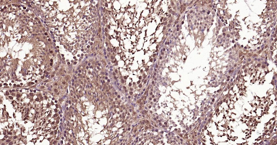泛素蛋白(K48-linkage)重组兔单抗