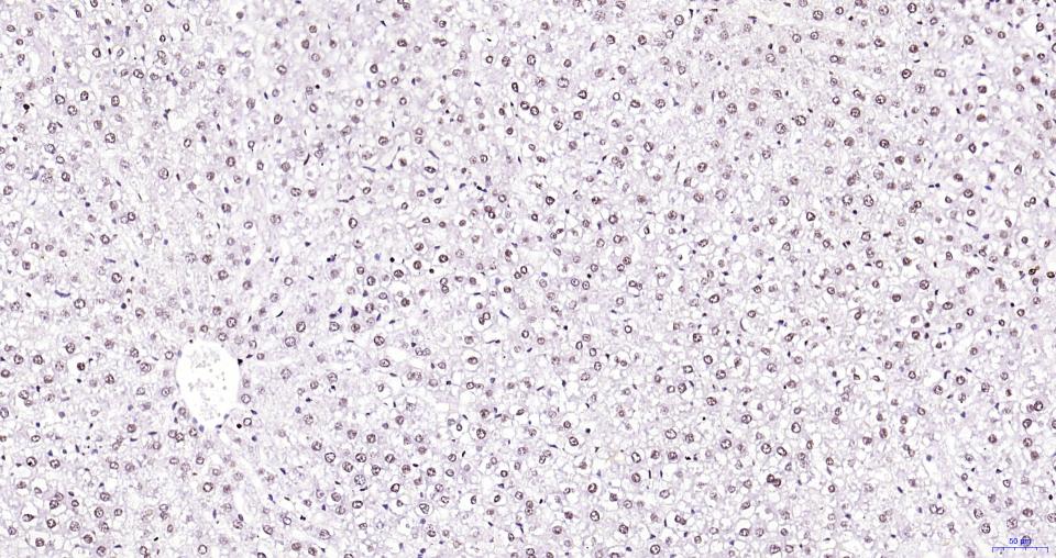 乙酰化组蛋白H3.1(Lys28)重组兔单抗