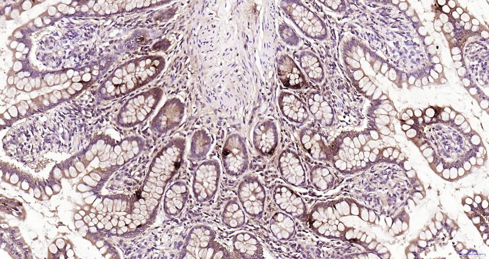 胰高血糖素重组兔单抗
