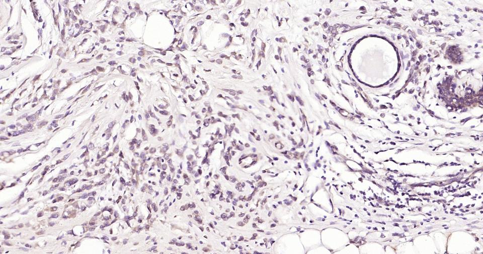 一种肿瘤抑制基因抗体
