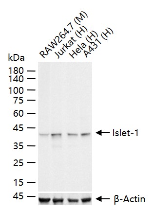 胰岛素基因增强结合蛋白1重组兔单抗