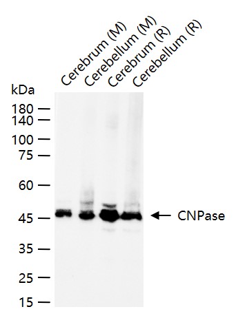 CNPase Recombinant Rabbit mAb (一抗) - WB,IHC-P,IHC-F,IF | Bioss