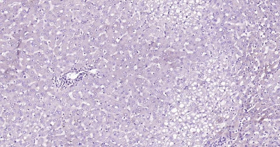 生长抑素重组兔单抗