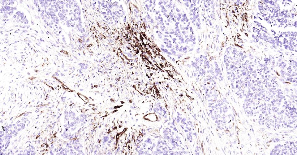 CD105抗体-bsm-41201M