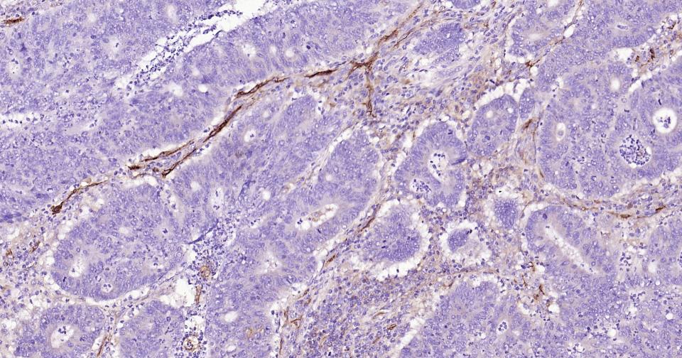 CD105 Mouse mAb (一抗) - IHC-P,IHC-F,IF | Bioss