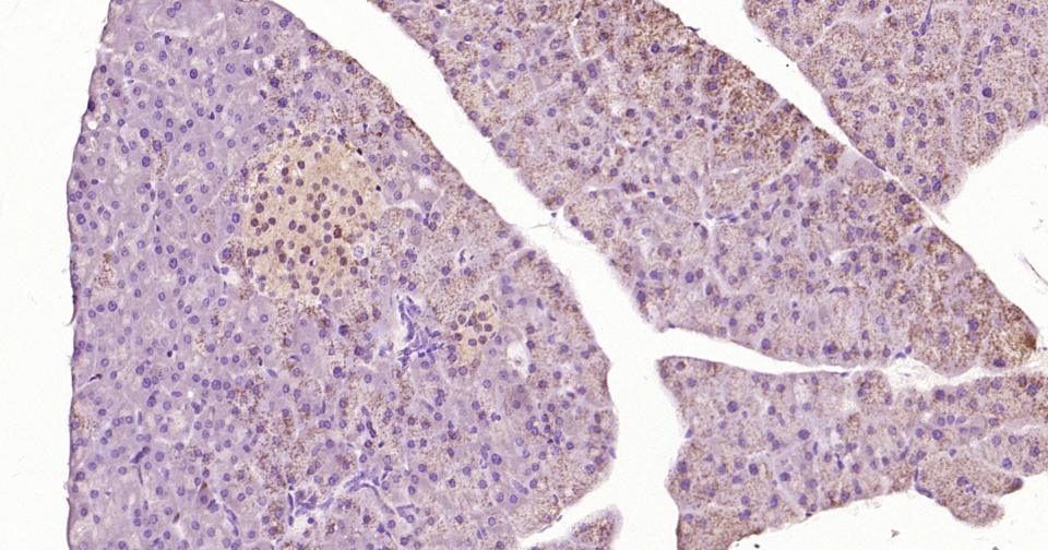 一种肿瘤抑制基因抗体