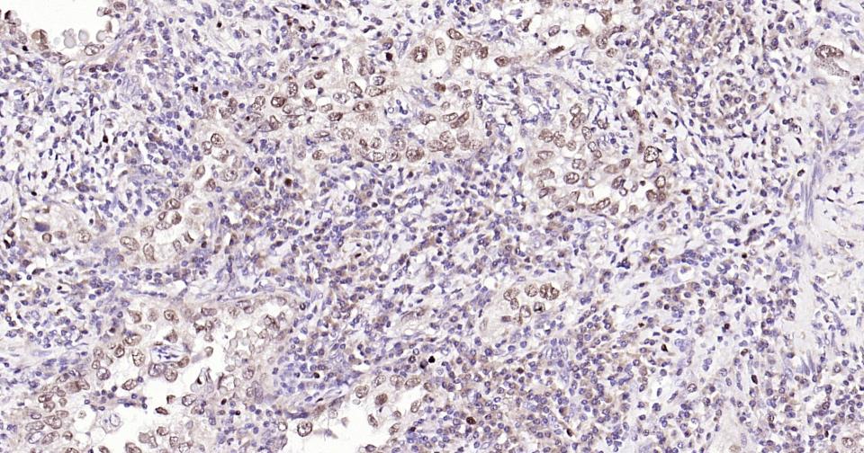 磷酸化核因子2相关因子2(Ser40)重组兔单抗