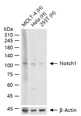 跨膜受体蛋白Notch-1重组兔单抗