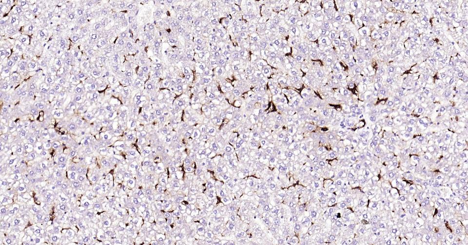 CD163重组兔单抗