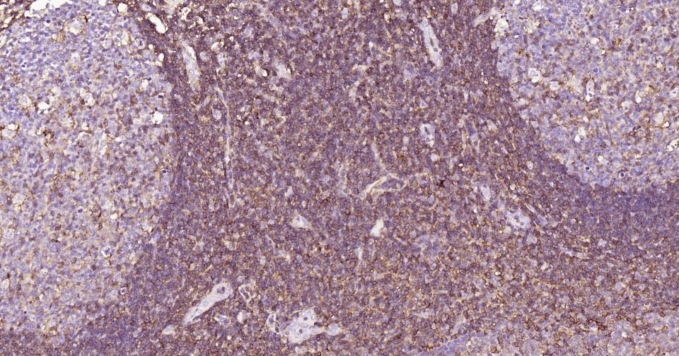 小鼠抗人CD44单克隆抗体-bsm-30038M