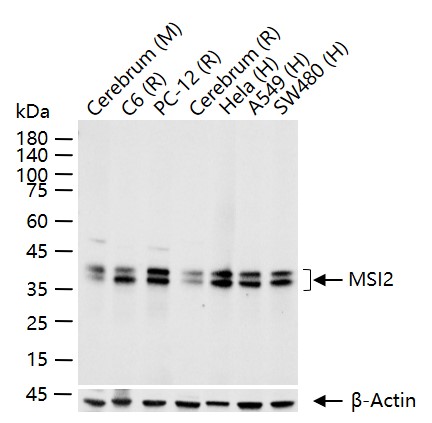 MSI2 Recombinant Rabbit mAb (一抗) - WB,IHC-P,IHC-F,IF,Flow-Cyt,ICC/IF | Bioss
