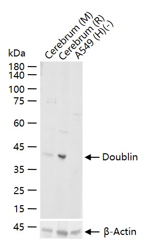 双皮质素重组兔单抗
