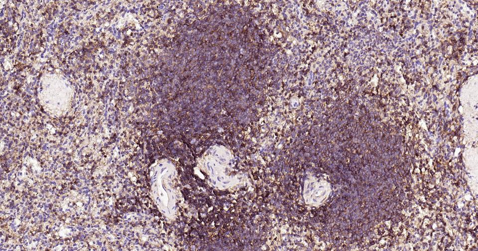 小鼠抗人CD44单克隆抗体-bsm-30038M