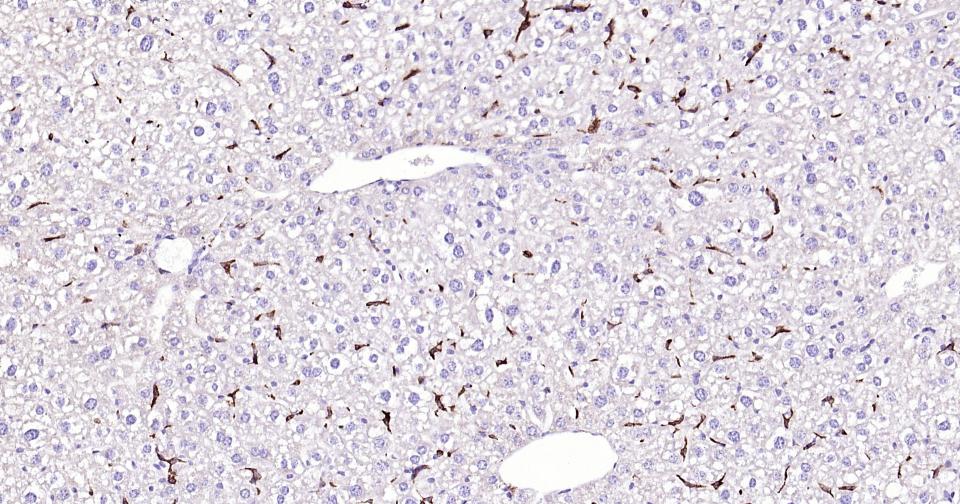 CD163重组兔单抗