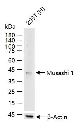 神经干细胞RNA结合蛋白Musashi1重组兔单抗