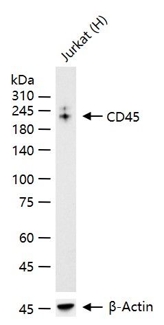 白细胞共同抗原CD45重组兔单抗