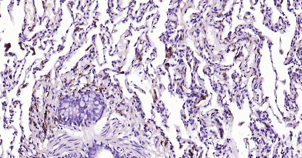 CD163重组兔单抗